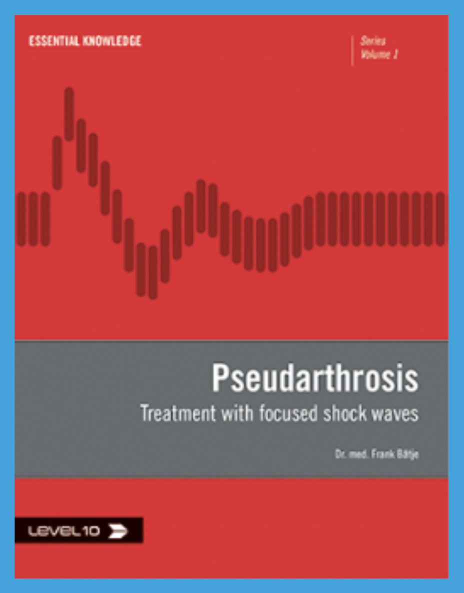 Pseudarthrosis Treatment with Focused Shockwaves